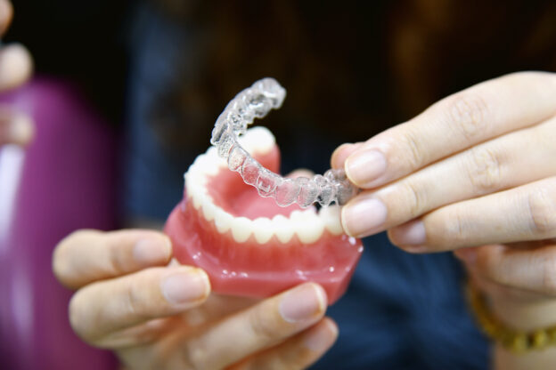 インビザラインと歯の模型